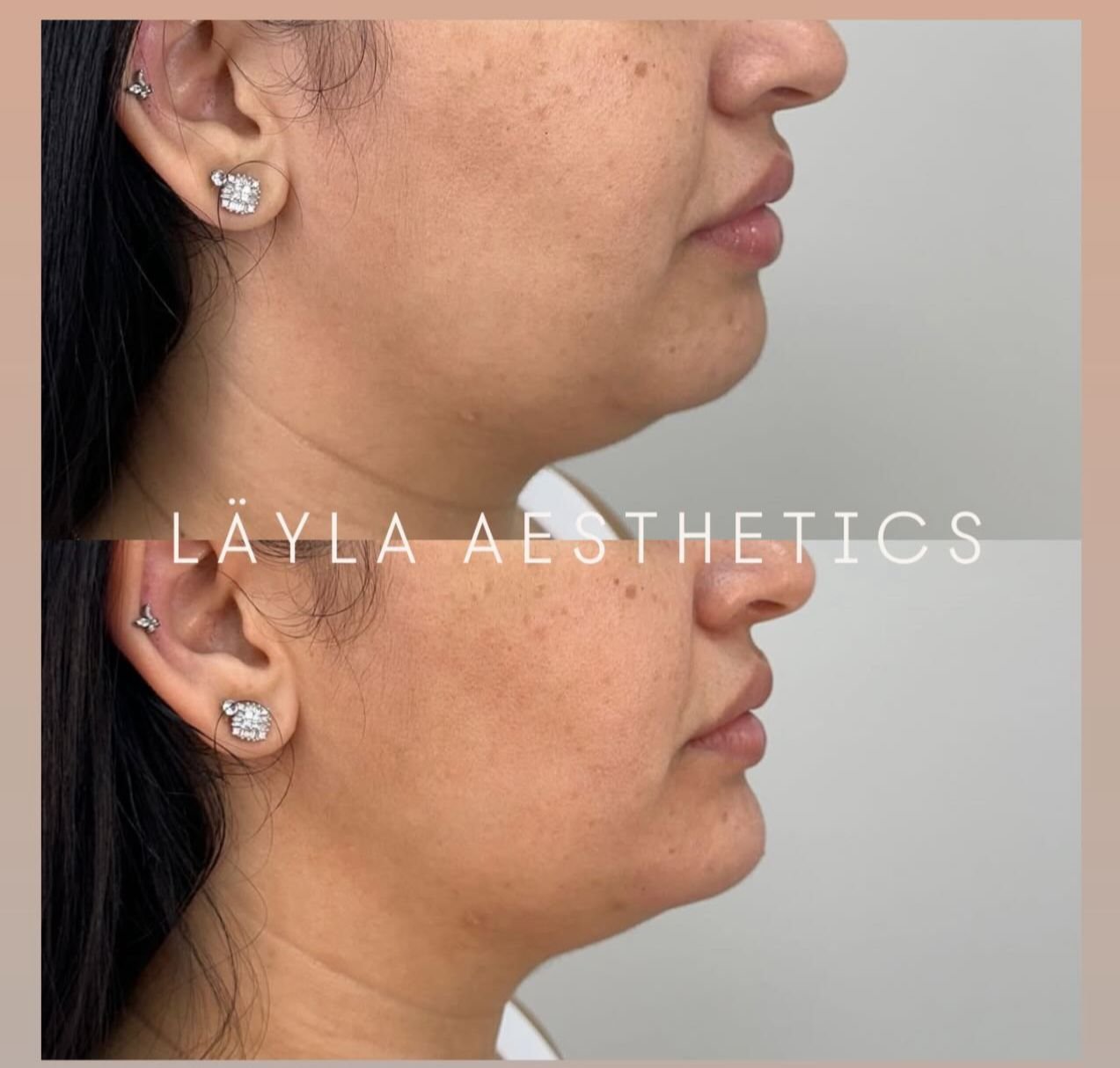 fat result near you bolton