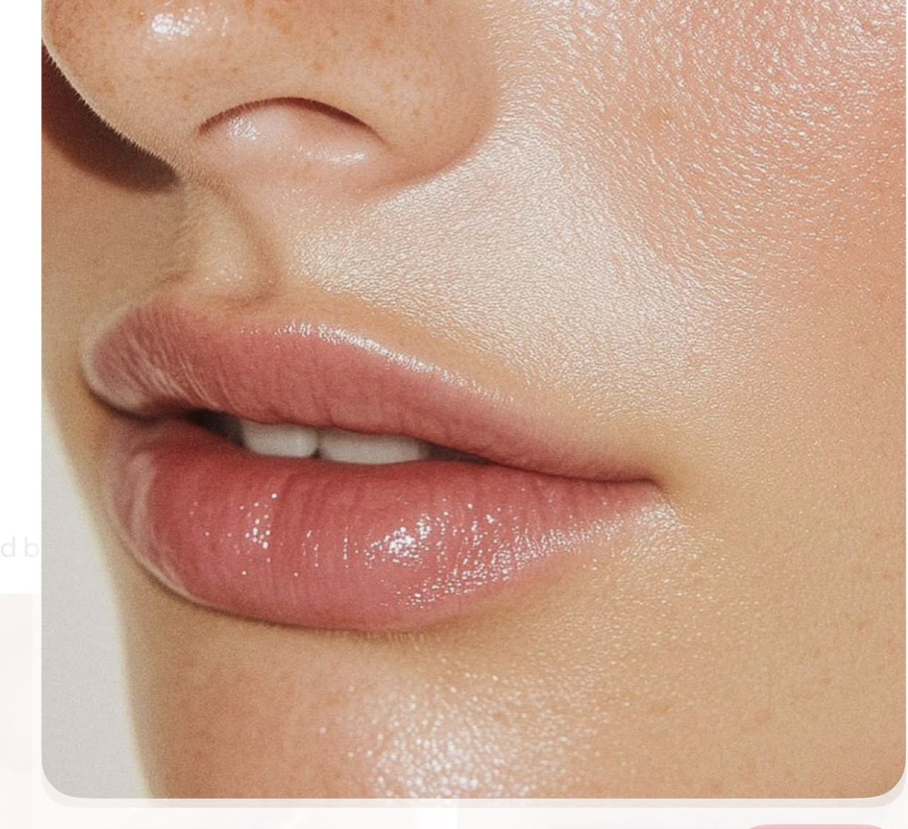 lip filler image